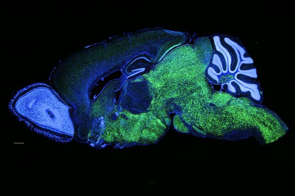 Expression patterns of NOVA1 in the brain of a mouse (Photo provided by the Darnell Institute)